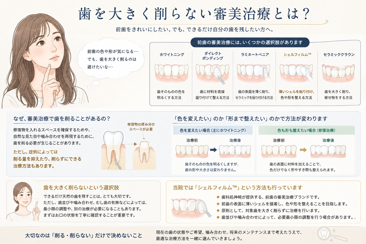 歯を大きく削らない前歯の審美治療とシェルフィルムの解説