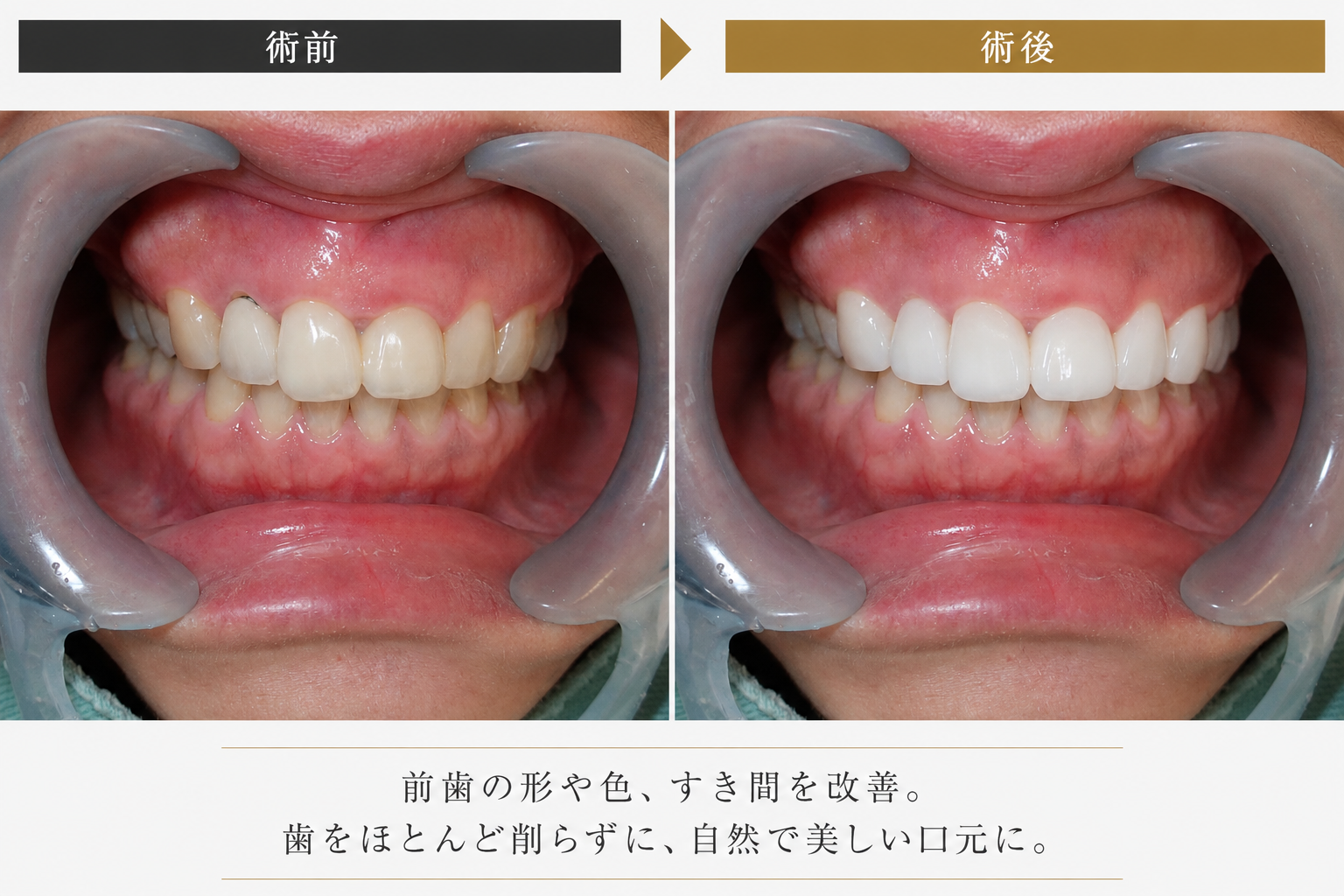 口元改善プランのイメージ