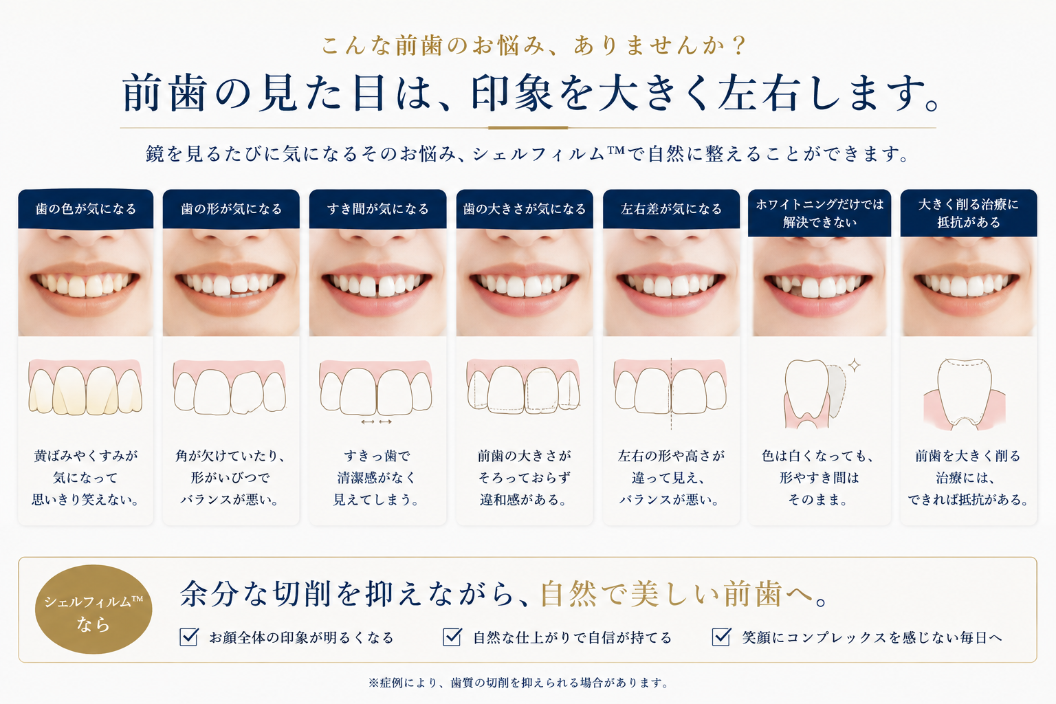 ラミネートベニアで相談される前歯の色・形・すき間のイメージ