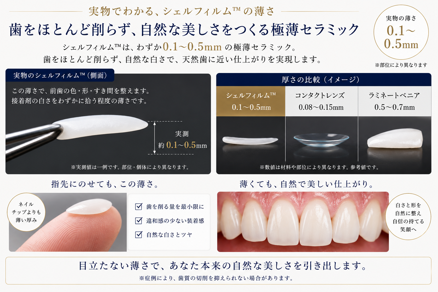 歯を大きく削らず極薄シェルを接着するラミネートベニアのイメージ