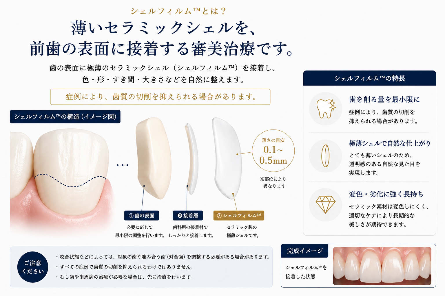 約0.1〜0.5mmの極薄シェルフィルムの構造イメージ