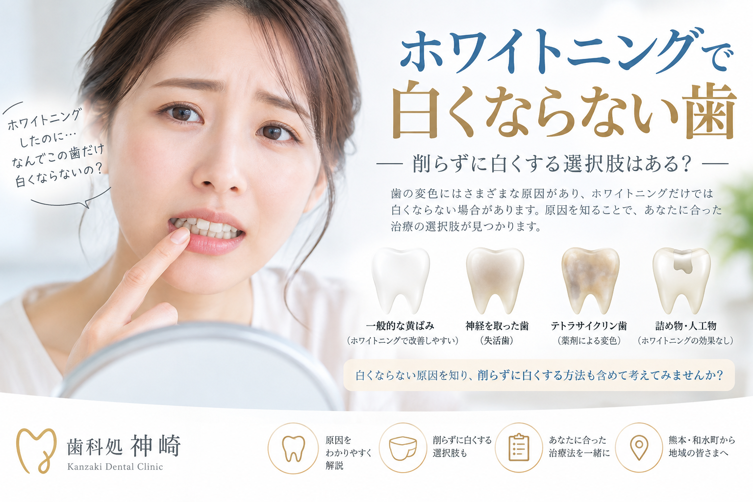ホワイトニングで白くならない歯