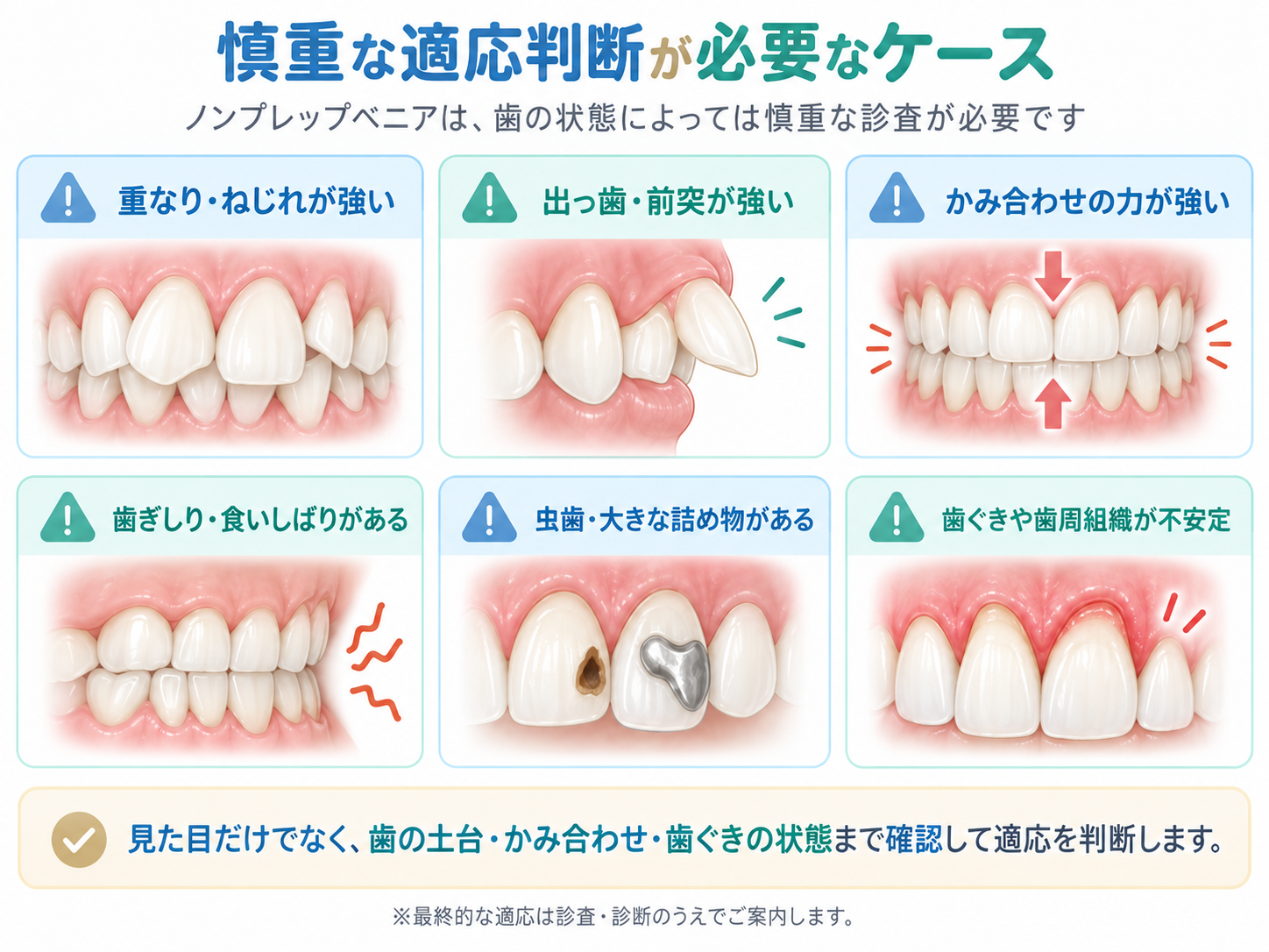 ノンプレップベニアの適応を慎重に判断するケースのイラスト